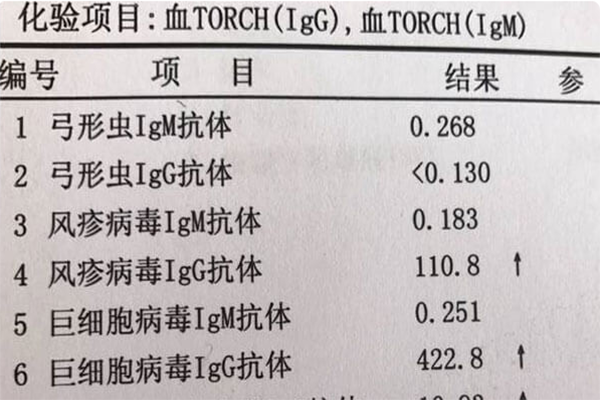 为什么医院不提倡孕妇做torch检查?