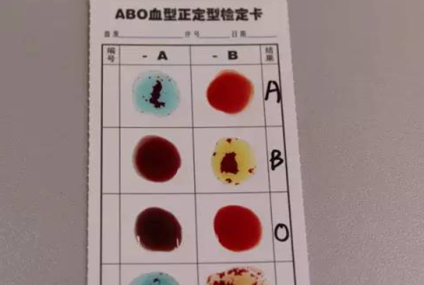 ABO溶血检查需要25元