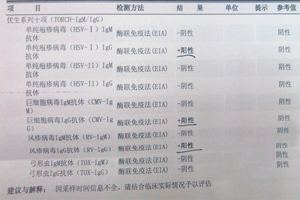 torch检查igg和igm的区别介绍，临床意义完全不一样