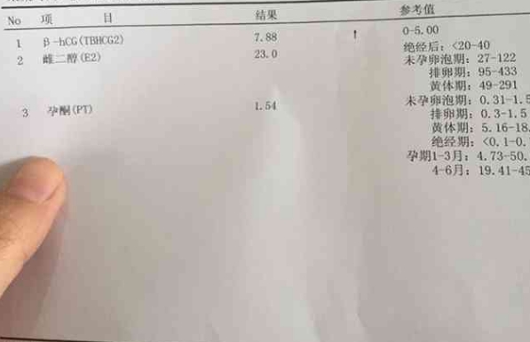 14天hcg多少以下是试管失败的表现？