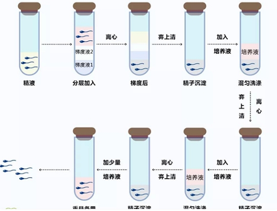 洗精有四个步骤