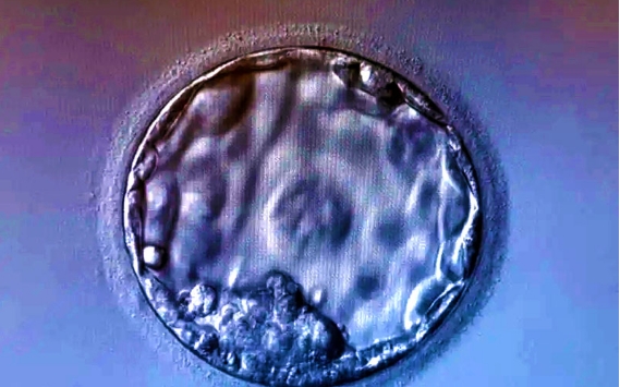 移植3BC的囊胚可能会成功