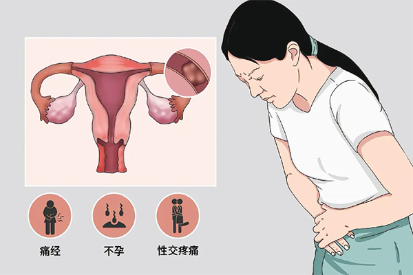 输卵管堵塞的10个征兆有哪些，腹部不适只是常规表现