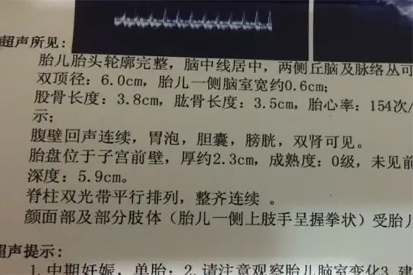 bpd hc ac fl正常值对照表分享，数据会随着孕周的增加而变化