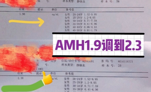 amh值回升可能是卵巢得到了改善