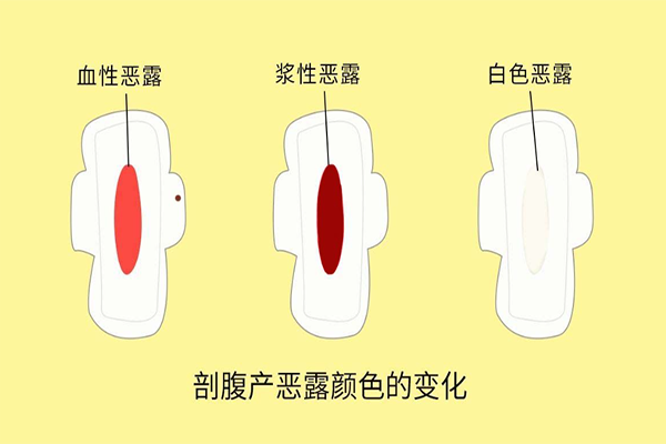 恶露颜色分三个阶段