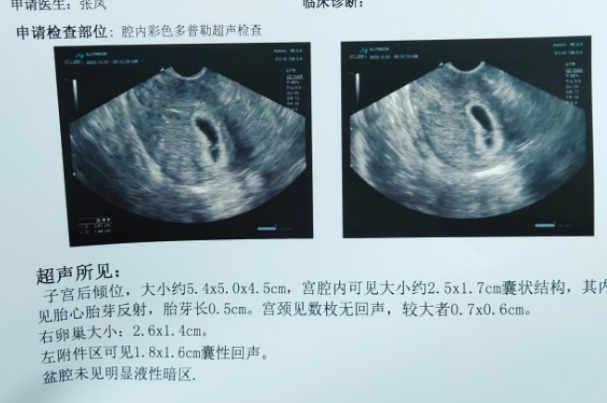 检查单上三个数据是长宽厚