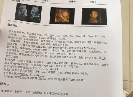 二维结果看超声描述