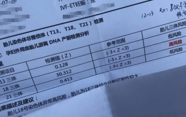 18三体高风险看男孩不准