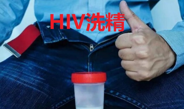 hiv洗精