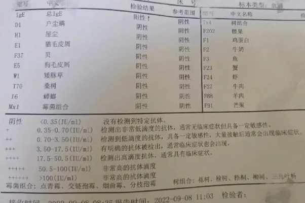 盘点家长给宝宝测过敏源后悔了的四大原因，检查意义不大是主因