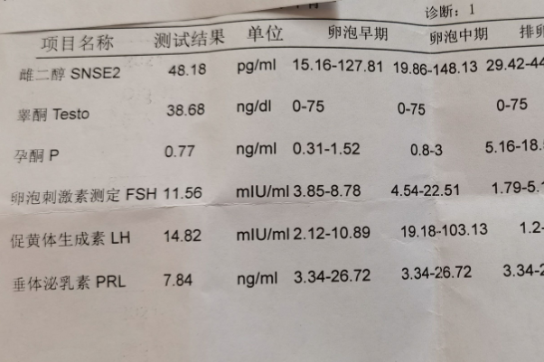 比值为2.6有多囊卵巢风险