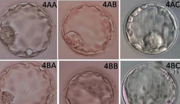 一般什么囊胚级别是男孩比较多？