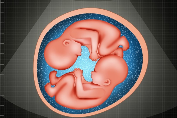 详谈150cm的身高试管怀双胞胎风险，严重时可能流产