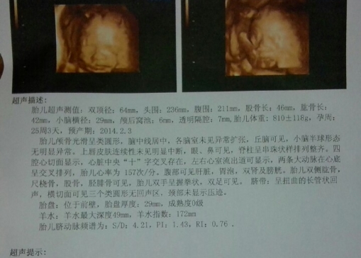 股骨长看性别无科学性