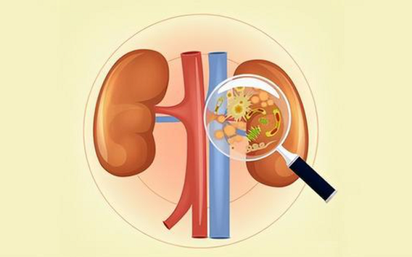肾功能检查主要检查肾脏疾病