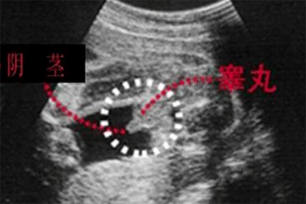 小鸡彩超图是短棒状